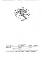 Искусственный желудочек сердца (патент 1331500)