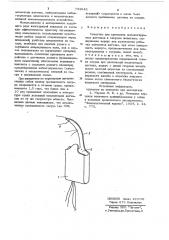 Средство для крепления имплантируемых датчиков к сосудам животных (патент 733643)