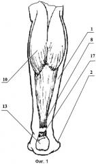 Способ лечения свежих разрывов ахиллова сухожилия (патент 2381761)