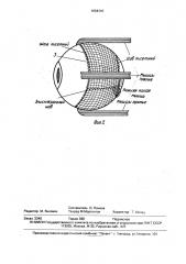 Эксплантат (патент 1664310)