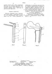 Фиксатор бедренной кости (патент 825043)
