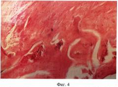 Способ изменения структуры костной ткани при экспериментальном стероидном остеопорозе (патент 2371189)
