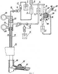 Устройство для эндоскопической санации желчных протоков (патент 2518139)