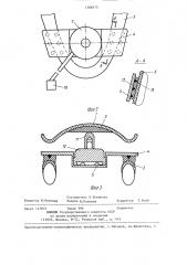 Устройство для определения центральной окклюзии (патент 1306575)