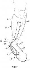 Голеностопный ортез (патент 2637825)