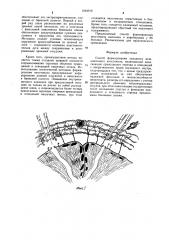 Способ формирования концевого межкишечного анастомоза (патент 1264916)