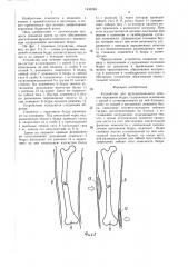 Устройство для функционального лечения переломов бедра (патент 1435248)