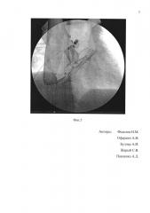 Способ и устройство визуализации в кардиохирургии (патент 2607948)