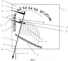 Устройство для обработки интервалов электрокардиограмм (патент 2261040)
