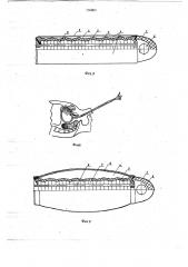 Катетер (патент 736983)