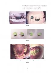 Способ ортодонтического лечения пациентов с дефектами твердых тканей зубов (патент 2645641)