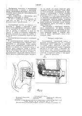 Калоприемник (патент 1461447)