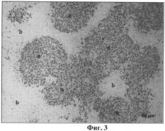 Штамм вируса болезни ньюкасла для создания на его основе кандидатного противоракового препарата и изучения механизмов онколизиса (патент 2482129)
