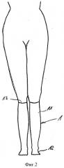 Компрессионная одежда (патент 2530362)