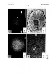 Способ получения искусственного зачатка зуба in vitro и полученный им искусственный зачаток зуба (патент 2638783)