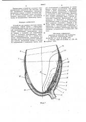 Устройство для прямого массажа сердца (патент 984477)