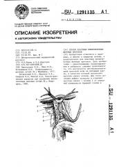 Способ пластики внепеченочных желчных протоков (патент 1291135)