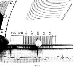 Устройство для обработки интервалов электрокардиограмм (патент 2261040)