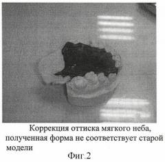 Способ изготовления разборной модели для протезов мягкого неба (патент 2406464)