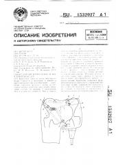 Крепление протеза после вычленения бедра (патент 1532027)
