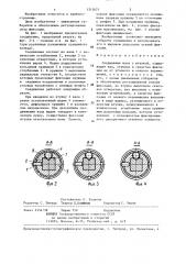 Соединение вала с втулкой (патент 1315671)