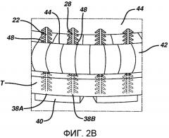 Шовные нити с зазубринами и стопорами для тампонов и способы их применения (патент 2535616)