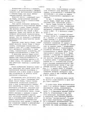 Протез бедра (патент 1109153)