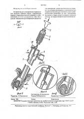 Устройство для определения подвижности опухоли прямой кишки (патент 1801353)