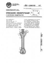 Внутрикостный фиксатор (патент 1386182)