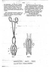 Зажим кровоостанавливающий (патент 719611)