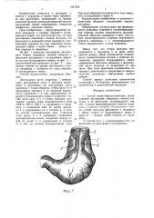 Способ эзофагофундопликации (патент 1447354)