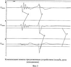 Устройство для измерения артериального давления в условиях двигательной активности человека (патент 2534416)