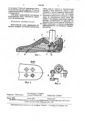 Искусственная стопа (патент 1680150)