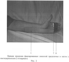 Устройство для разработки лучезапястного сустава и пальцев кисти (патент 2487695)