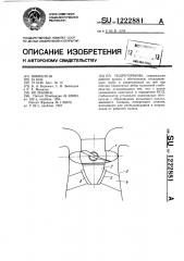 Гидротурбина (патент 1222881)