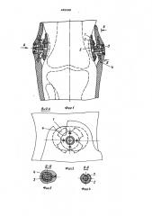Устройство для крепления протеза голени (патент 452339)