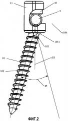Имплантат с многоосной головкой для закрепления в кости (патент 2302839)