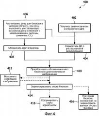 Способ и система для выполнения биопсии (патент 2510699)