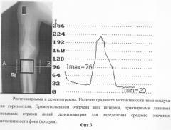 Способ фотоденситометрии рентгенограмм или их оцифрованных изображений (патент 2281030)