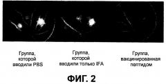 Вакцинотерапия неоваскуляризации сосудистой оболочки глаза (патент 2481118)