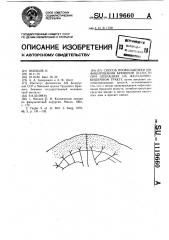 Способ профилактики инфицирования брюшной полости при операциях на желудочно-кишечном тракте (патент 1119660)