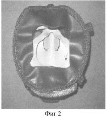 Облегченное защитное дыхательное устройство (патент 2321436)