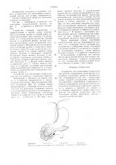 Устройство для гипотермии поджелудочной железы (патент 1378835)