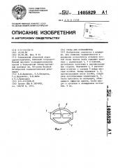 Скоба для остеосинтеза (патент 1405829)