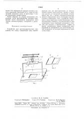 Устройство для рентгенодиагностики инородных тел глаза (патент 179418)