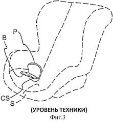 Пряжка и блок ремня безопасности для детского сиденья для транспортного средства (патент 2506871)