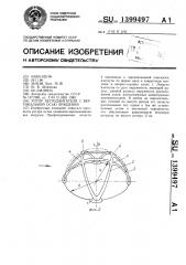 Ротор ветродвигателя с вертикальной осью вращения (патент 1399497)