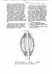 Устройство для центрирования скважинного прибора акустического каротажа (патент 717685)