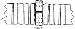 Способ формирования анастомоза трахеи (патент 2382608)