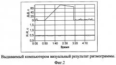 Способ функциональной предоперационной диагностики послеоперационных осложнений у пациентов после протезирующей герниопластики по поводу послеоперационных грыж (патент 2491885)